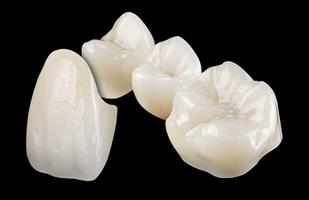 Close-up picture of upper and lower perfect teeth shown with Emax pure porcelain Zirconium crowns