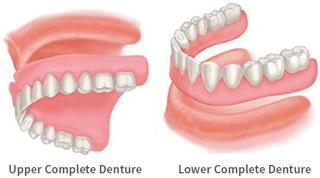 Illustration of a set of upper and lower full dentures